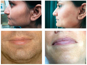 IPL white Hair Removal | Hair Removal Tool | Girly Butik